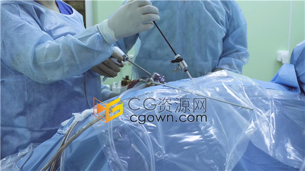 实拍视频4K分辨率下载医生腹腔镜手术台操作场景素材
